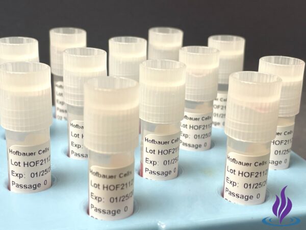Hofbauer Cells (Macrophages)